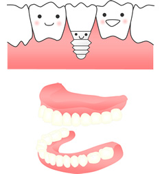 �C���v�����g���ÁA���ꎕ