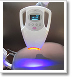 オフィスホワイトニング